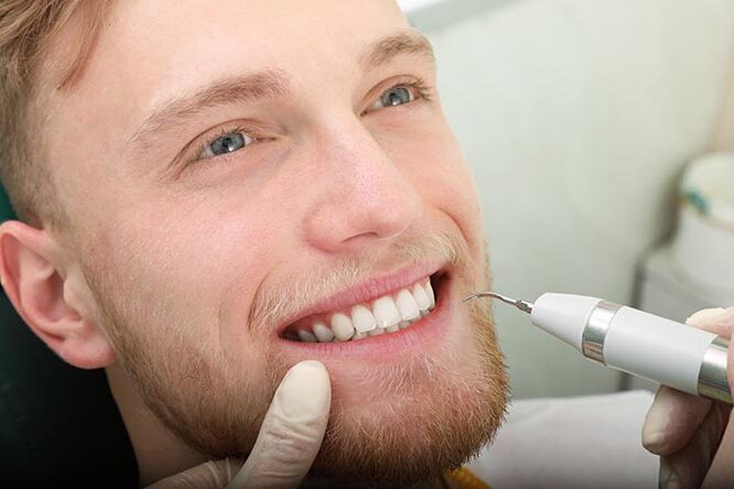 Was ist eigentlich Zahnstein?