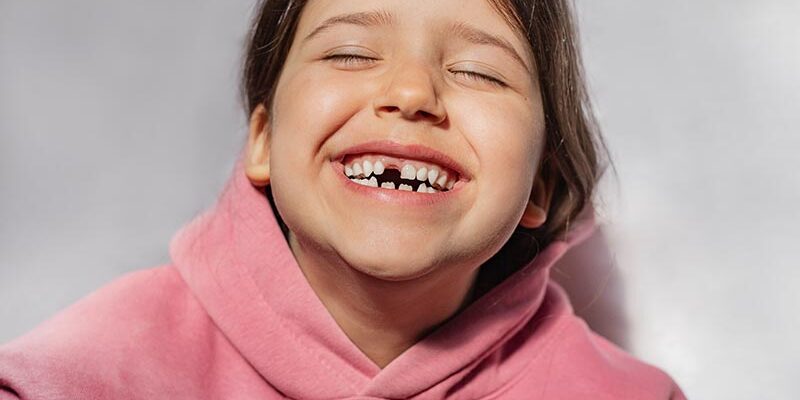 Zahndurchbruchstörung: Wenn die Zähne auf sich warten lassen